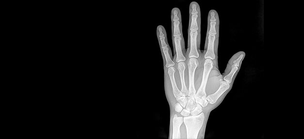 röntgen, x-ray, hand, gesundheit, medizin, untersuchung